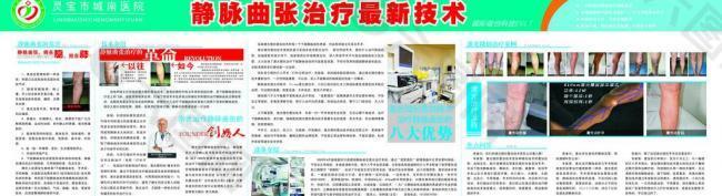 靜脈曲張新療法觀點(diǎn)論述與解析